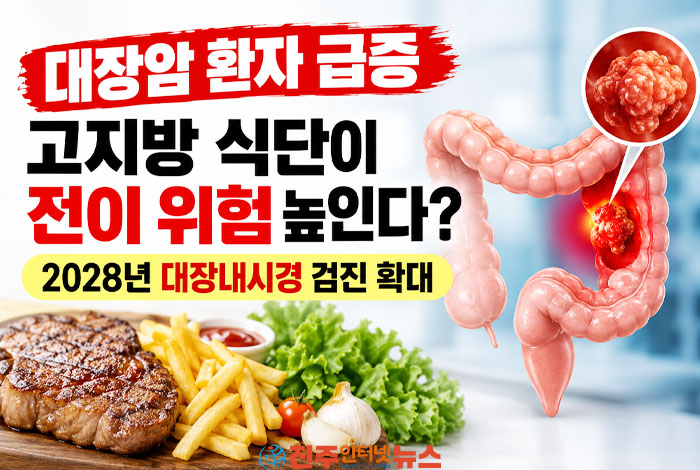 대장암 3만2610명 시대…혈변을 치질로 넘기면 안 되는 이유