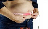 지방흡입, 정말 안전할까?…효과만 보고 결정했다간 치명적 합병증 위험