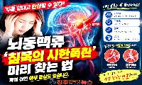 두통 없다고 안심할 수 없다…뇌동맥류 ‘침묵의 시한폭탄’ 미리 찾는 법